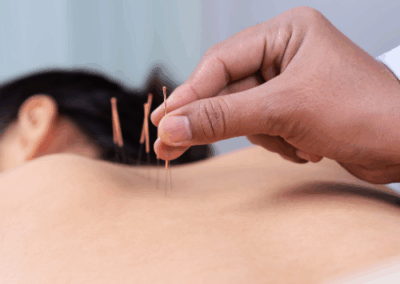 Acupuncture therapy, pain relief, traditional Chinese medicine, energy balance