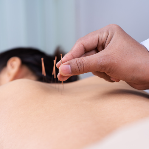 Acupuncture therapy, pain relief, traditional Chinese medicine, energy balance